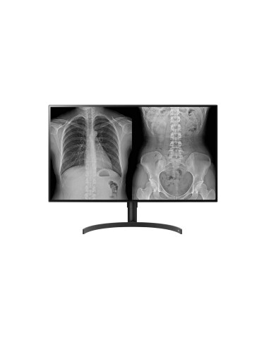 Monitor Komputerowy Lg 32Hl512D-B 80 Cm 3840 X 2160 Px Full Hd Czarny