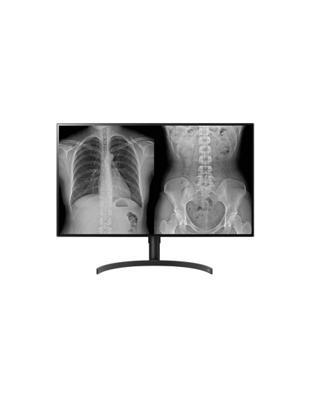 Monitor Komputerowy Lg 32Hl512D-B 80 Cm 3840 X 2160 Px Full Hd Czarny