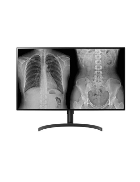 Monitor Komputerowy Lg 32Hl512D-B 80 Cm 3840 X 2160 Px Full Hd Czarny